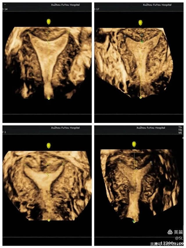 1651739699832741.jpg 微信图片_20220505162958.jpg