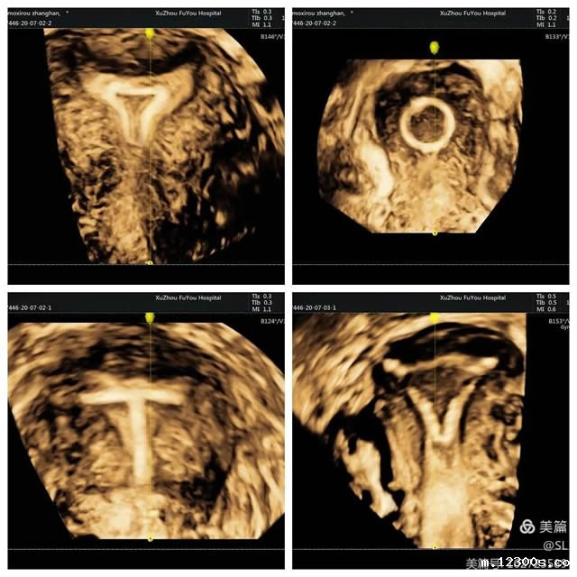 1651739721265046.jpg 微信图片_20220505163001.jpg