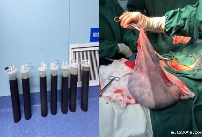 1701848364285279.jpg 图片2.jpg