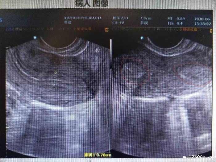 1705989391489833.jpg 640.jpg